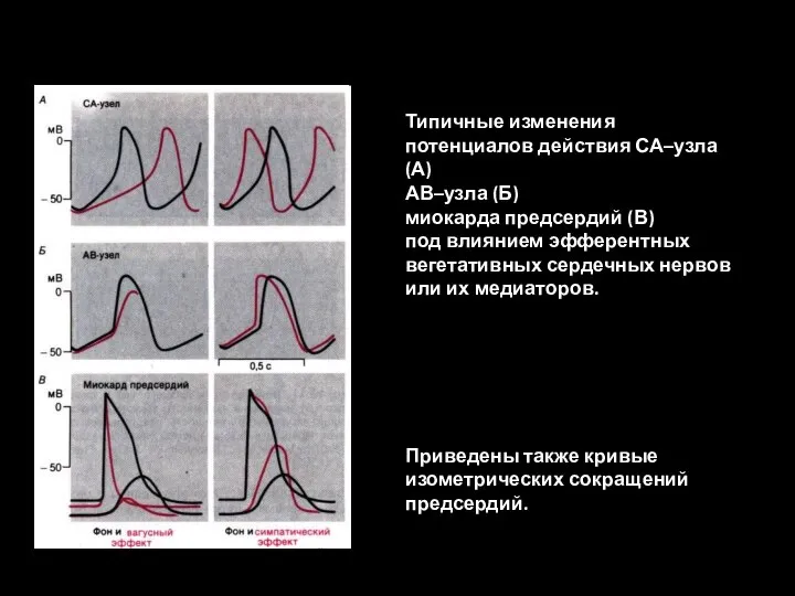 Типичные изменения потенциалов действия СА–узла (А) АВ–узла (Б) миокарда предсердий (В) под