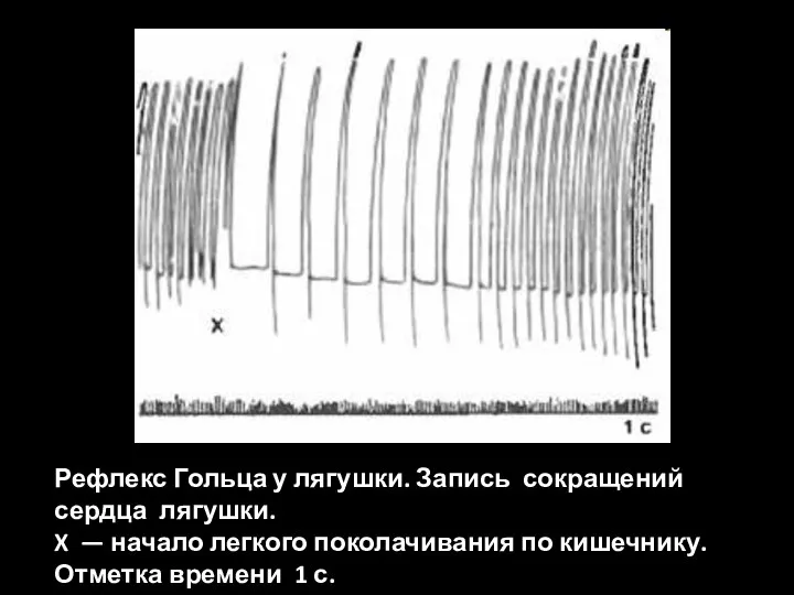 Рефлекс Гольца у лягушки. Запись сокращений сердца лягушки. X — начало легкого