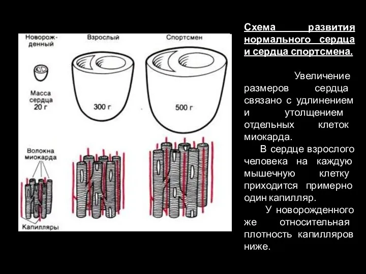 Схема развития нормального сердца и сердца спортсмена. Увеличение размеров сердца связано с