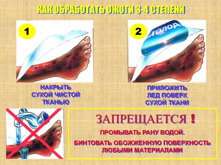 КАК ОБРАБОТАТЬ ОЖОГИ 3-4 СТЕПЕНИ НАКРЫТЬ СУХОЙ ЧИСТОЙ ТКАНЬЮ ПРИЛОЖИТЬ ЛЕД ПОВЕРХ СУХОЙ ТКАНИ