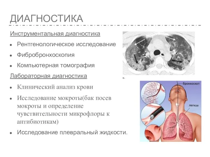 ДИАГНОСТИКА Инструментальная диагностика Рентгенологическое исследование Фибробронхоскопия Компьютерная томография Лабораторная диагностика Клинический анализ