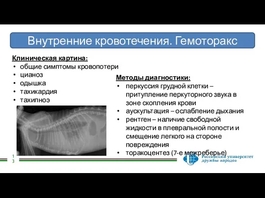 Внутренние кровотечения. Гемоторакс Клиническая картина: общие симптомы кровопотери цианоз одышка тахикардия тахипноэ