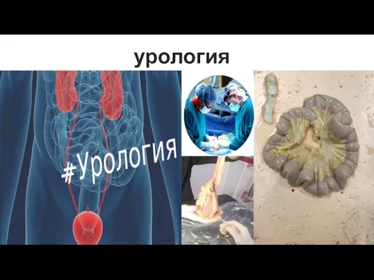 урология