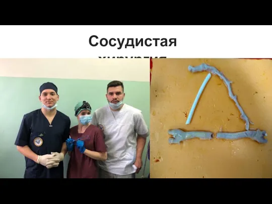 Сосудистая хирургия