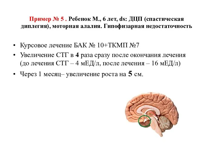 Пример № 5 . Ребенок М., 6 лет, ds: ДЦП (спастическая диплегия),