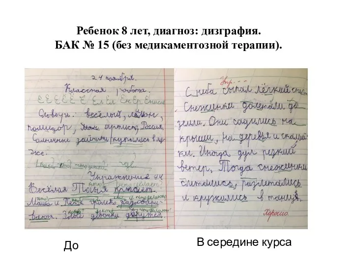 Ребенок 8 лет, диагноз: дизграфия. БАК № 15 (без медикаментозной терапии). До В середине курса