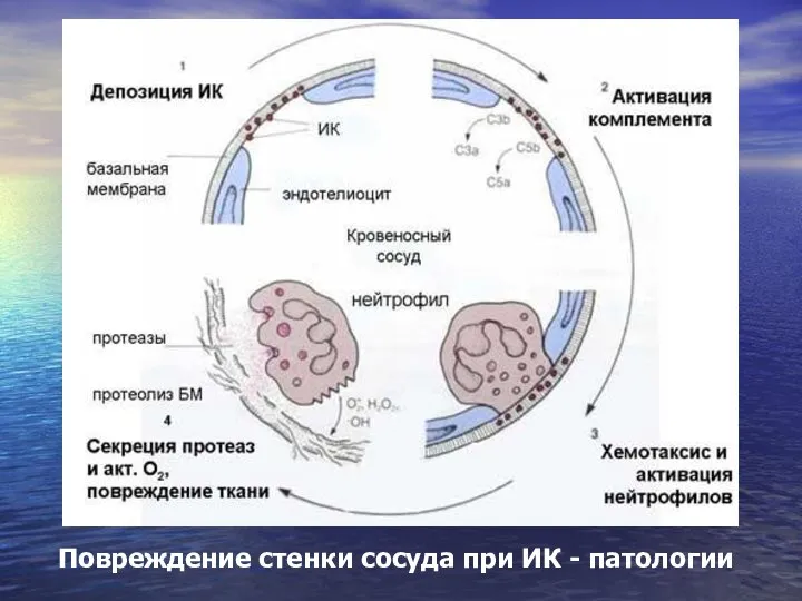 Повреждение стенки сосуда при ИК - патологии