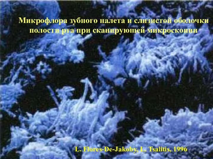 Микрофлора зубного налета и слизистой оболочки полости рта при сканирующей микроскопии L. Flores-De-Jakoby, L. Tsalitis, 1996