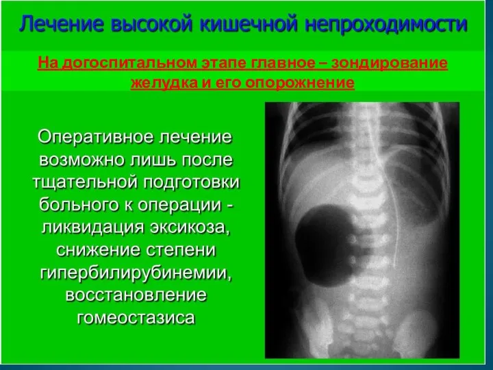 На догоспитальном этапе главное – зондирование желудка и его опорожнение