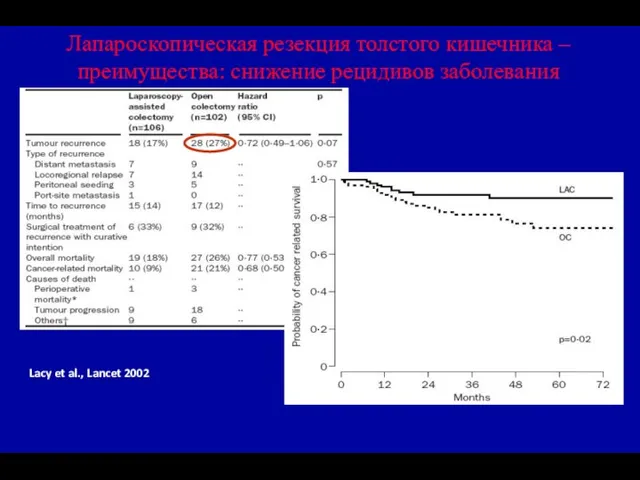 Лапароскопическая резекция толстого кишечника – преимущества: снижение рецидивов заболевания Lacy et al., Lancet 2002