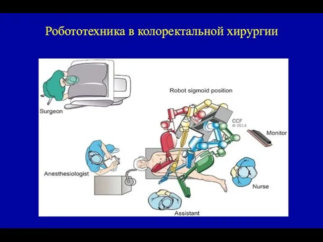 Робототехника в колоректальной хирургии