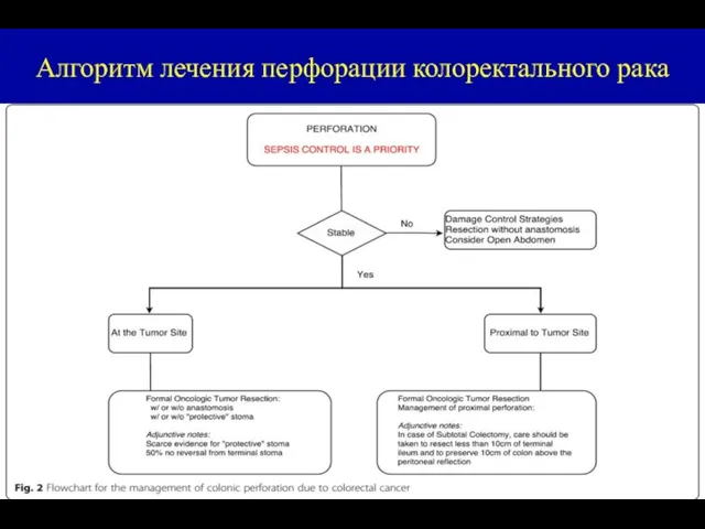 Алгоритм лечения перфорации колоректального рака