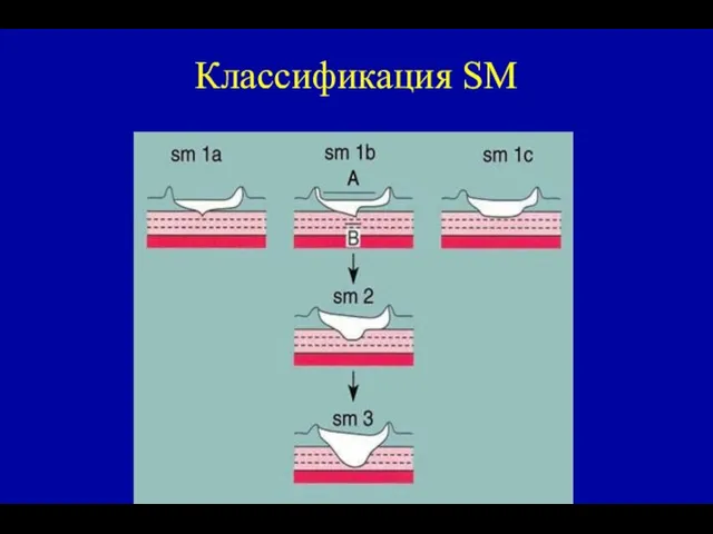 Классификация SM