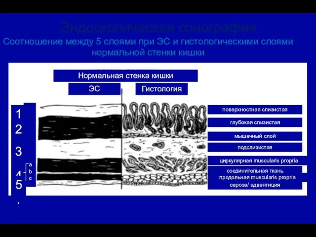 Соотношение между 5 слоями при ЭС и гистологическими слоями нормальной стенки кишки