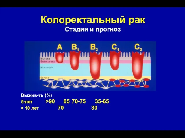 Колоректальный рак Стадии и прогноз Выжив-ть (%) 5-лет >90 85 70-75 35-65