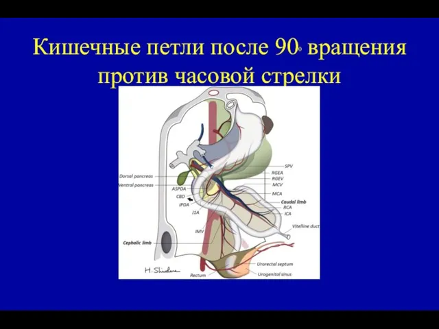 Кишечные петли после 900 вращения против часовой стрелки