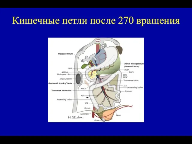 Кишечные петли после 270 вращения