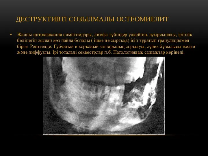 ДЕСТРУКТИВТІ СОЗЫЛМАЛЫ ОСТЕОМИЕЛИТ Жалпы интоксикация симптомдары, лимфа түйіндер улкейген, ауырсынады, іріндік бөлінетін