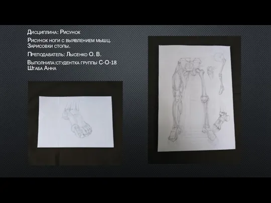 Дисциплина: Рисунок Рисунок ноги с выявлением мышц. Зарисовки стопы. Преподаватель: Лысенко О.