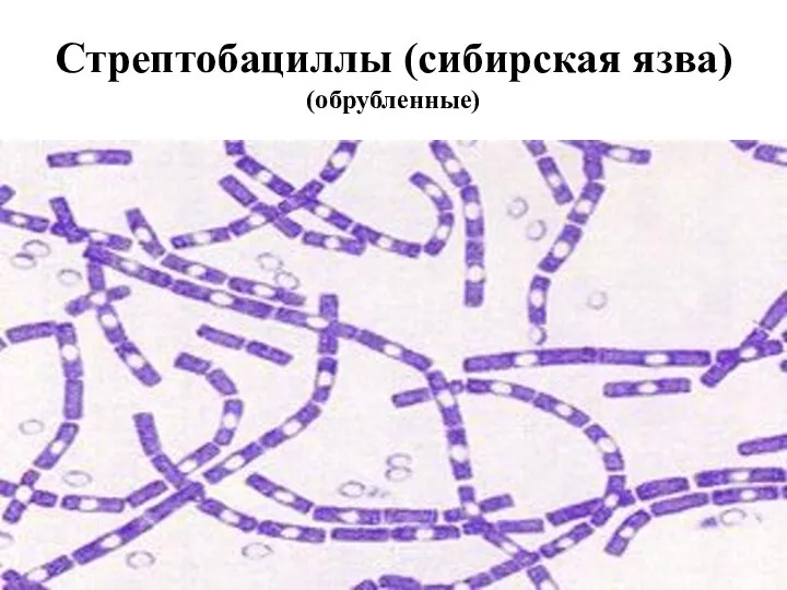Стрептобациллы (сибирская язва) (обрубленные)