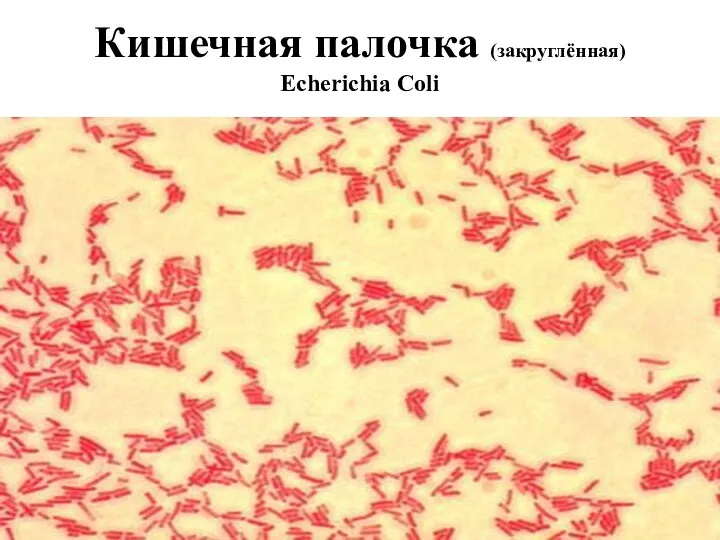 Кишечная палочка (закруглённая) Echerichia Coli