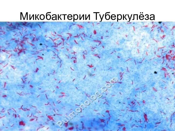 Микобактерии Туберкулёза