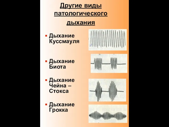 Другие виды патологического дыхания Дыхание Куссмауля Дыхание Биота Дыхание Чейна – Стокса Дыхание Грокка