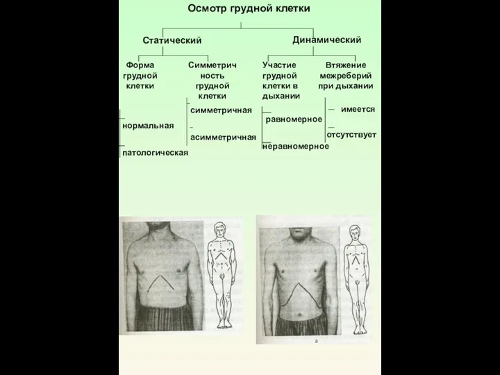 Осмотр грудной клетки Статический Динамический Форма грудной клетки Симметричность грудной клетки Участие