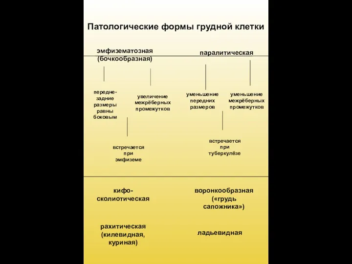 Патологические формы грудной клетки эмфизематозная (бочкообразная) паралитическая рахитическая (килевидная, куриная) воронкообразная («грудь