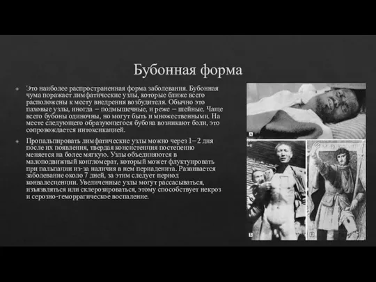 Бубонная форма Это наиболее распространенная форма заболевания. Бубонная чума поражает лимфатические узлы,