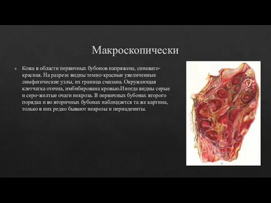 Макроскопически Кожа в области первичных бубонов напряжена, синевато-красная. На разрезе видны темно-красные