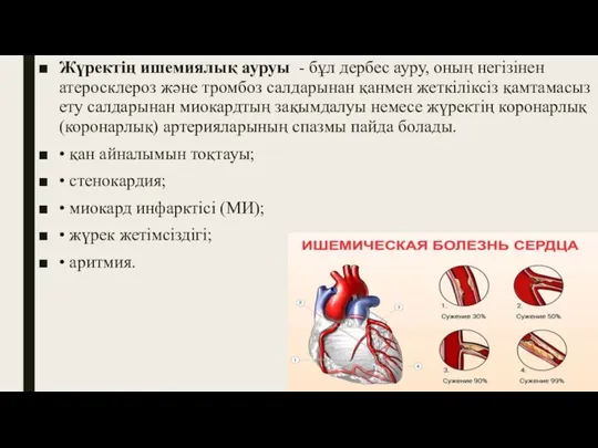 Жүректің ишемиялық ауруы - бұл дербес ауру, оның негізінен атеросклероз және тромбоз