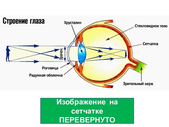 Изображение на сетчатке ПЕРЕВЕРНУТО