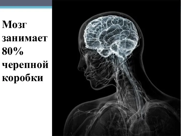 Мозг занимает 80% черепной коробки
