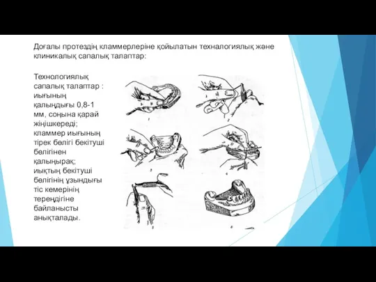 Доғалы протездің кламмерлеріне қойылатын техналогиялық және клиникалық сапалық талаптар: Технологиялық сапалық талаптар