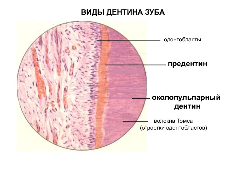 ВИДЫ ДЕНТИНА ЗУБА околопульпарный дентин одонтобласты волокна Томса (отростки одонтобластов) предентин