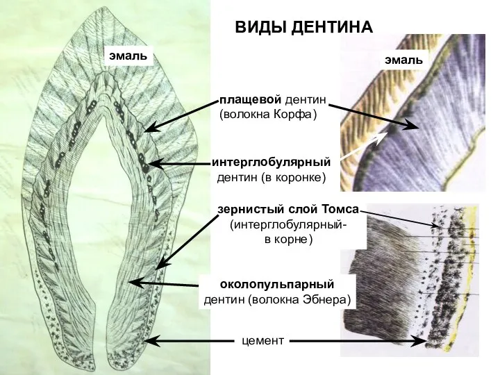 ВИДЫ ДЕНТИНА плащевой дентин (волокна Корфа) Околопульпарный дентин (волокна Эбнера) интерглобулярный дентин