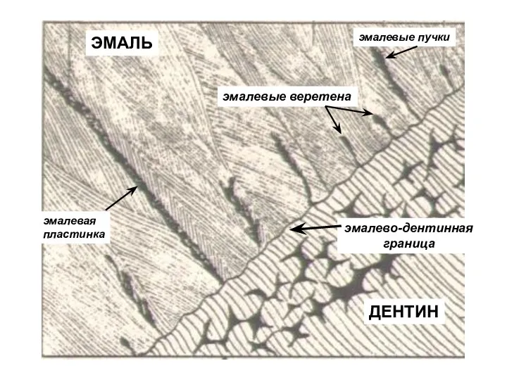 ЭМАЛЬ ДЕНТИН эмалевая пластинка эмалевые пучки эмалевые веретена эмалево-дентинная граница