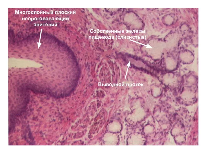 Многослойный плоский неороговевающий эпителий Собственные железы пищевода (слизистые) Выводной проток