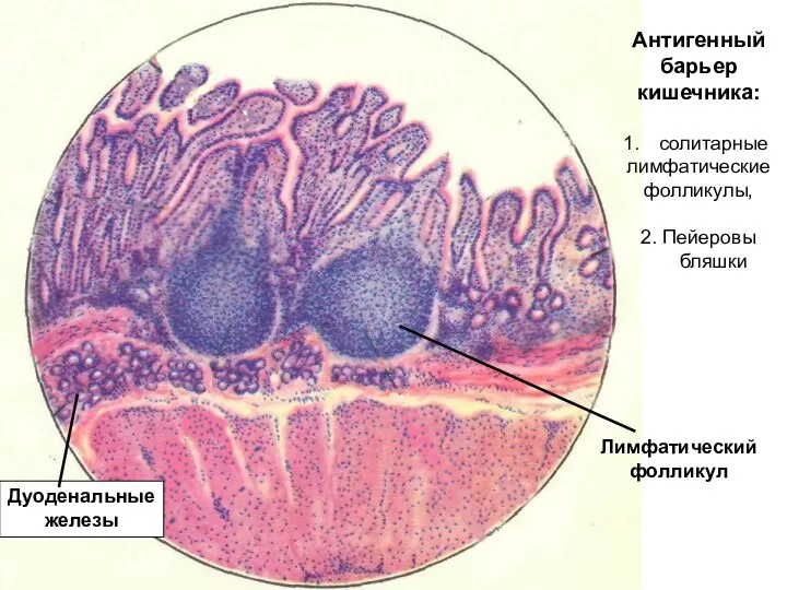 Лимфатический фолликул Дуоденальные железы Антигенный барьер кишечника: солитарные лимфатические фолликулы, 2. Пейеровы бляшки