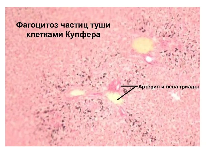Фагоцитоз частиц туши клетками Купфера Артерия и вена триады