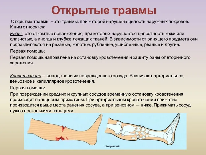 Открытые травмы Открытые травмы – это травмы, при которой нарушена целость наружных