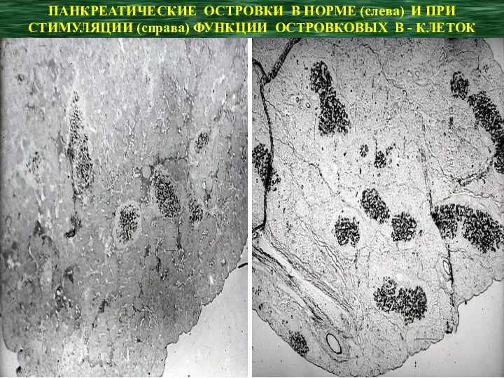 ПАНКРЕАТИЧЕСКИЕ ОСТРОВКИ В НОРМЕ (слева) И ПРИ СТИМУЛЯЦИИ (справа) ФУНКЦИИ ОСТРОВКОВЫХ В - КЛЕТОК