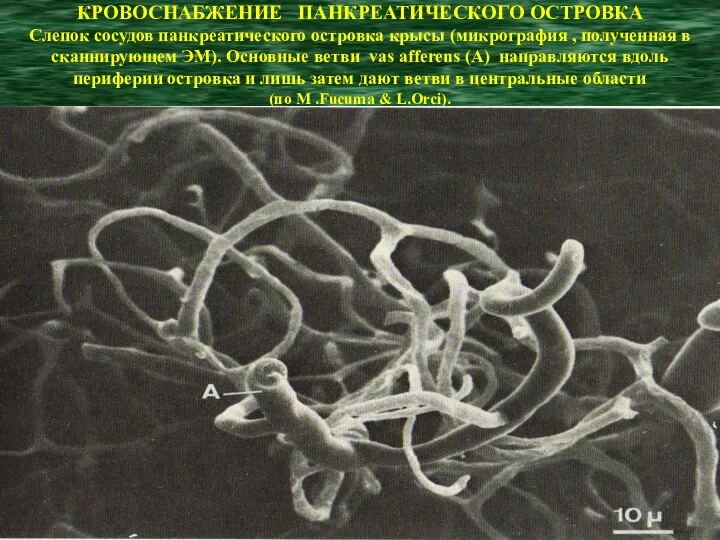 КРОВОСНАБЖЕНИЕ ПАНКРЕАТИЧЕСКОГО ОСТРОВКА Слепок сосудов панкреатического островка крысы (микрография , полученная в