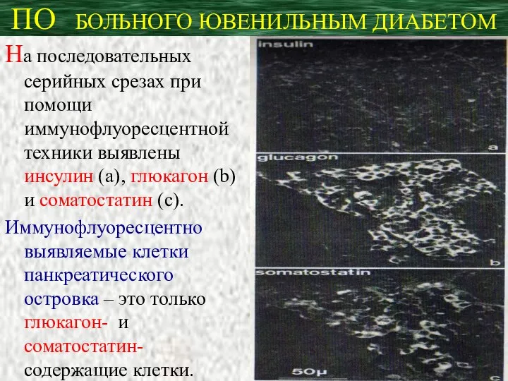 ПО БОЛЬНОГО ЮВЕНИЛЬНЫМ ДИАБЕТОМ На последовательных серийных срезах при помощи иммунофлуоресцентной техники