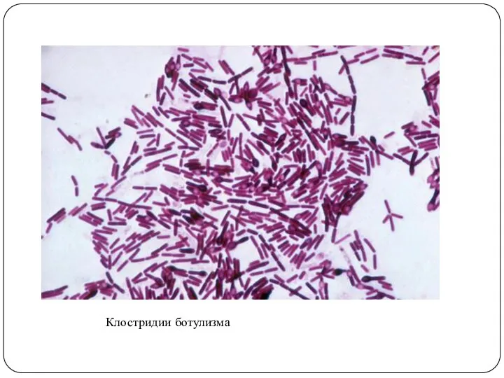 Клостридии ботулизма