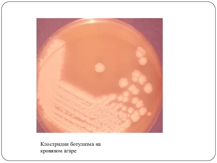 Клостридии ботулизма на кровяном агаре