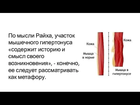 По мысли Райха, участок мышечного гипертонуса «содержит историю и смысл своего возникновения»,