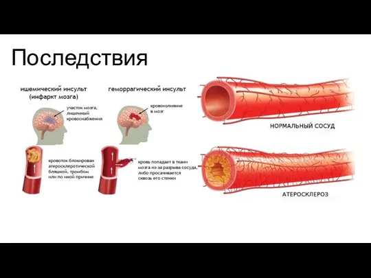 Последствия