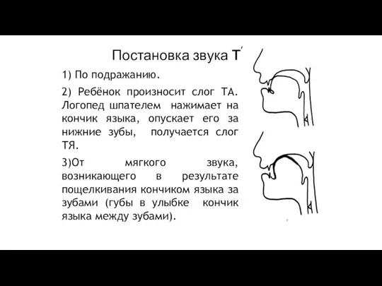 Постановка звука Т 1) По подражанию. 2) Ребёнок произносит слог ТА. Логопед